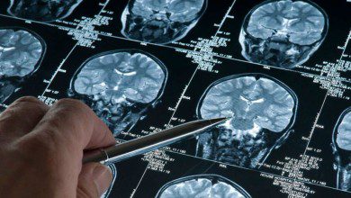 ١.٢ مليار رنجت لافتتاح مركز علوم الأعصاب للسياحة العلاجية في ٢٠٢٣