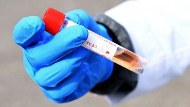 الصحة تعلن عن 10 إصابات جديدة بفيروس كورونا في ماليزيا