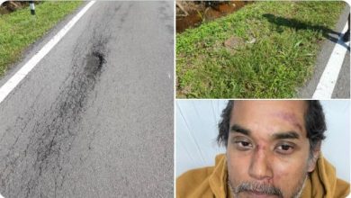 حفرة تتسبب بإصابة وزير العلوم والتكنولوجيا الماليزي أثناء قيادة دراجته الهوائية