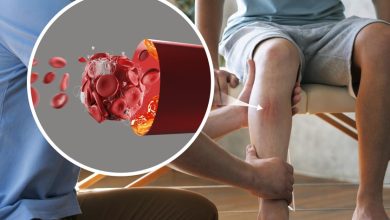 الخطوات القاتلة لمرض الشريان المحيطي رحلة التعافي الناجح تبدأ بخطوة واحدة