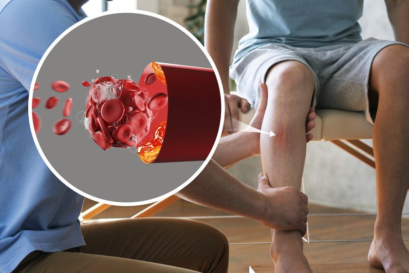 الخطوات القاتلة لمرض الشريان المحيطي رحلة التعافي الناجح تبدأ بخطوة واحدة