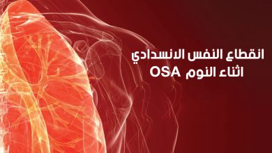 المعاناة من انقطاع النفس الانسدادي أثناء النوم "OSA"